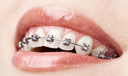 7 Types of Braces and Orthotics to Relieve Pain: The Woodlands